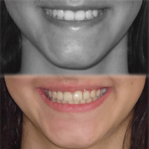 img-resultados (11)