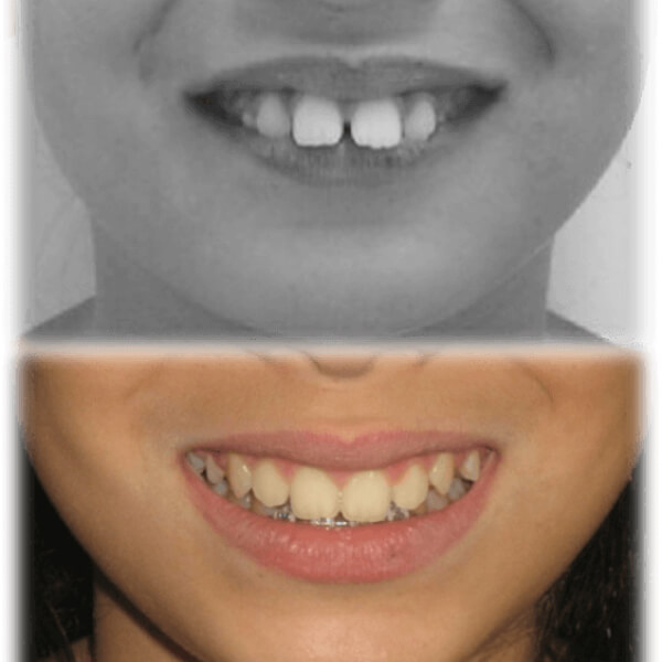 img-resultados (12)