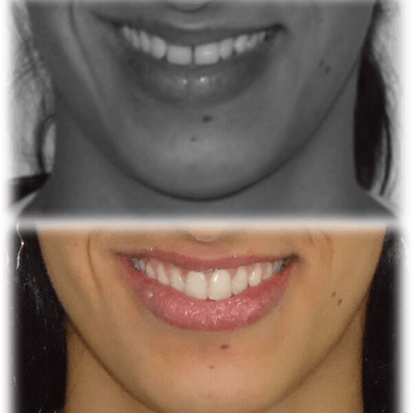 img-resultados (3)