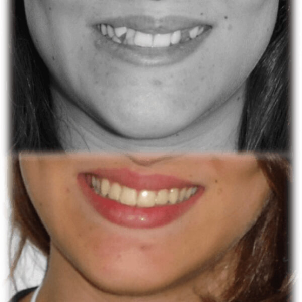img-resultados (4)