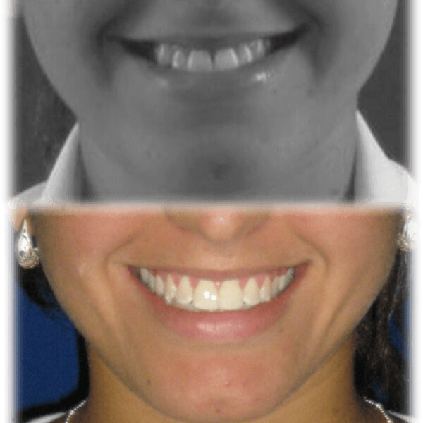 img-resultados (5)